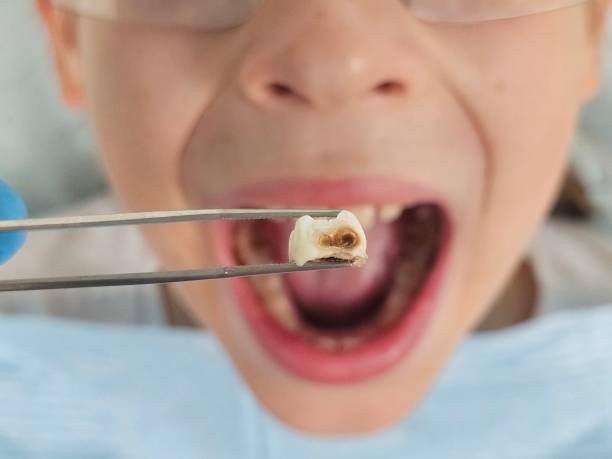 Best Emergency Dental Care for Trauma or Injury in Orting, WA